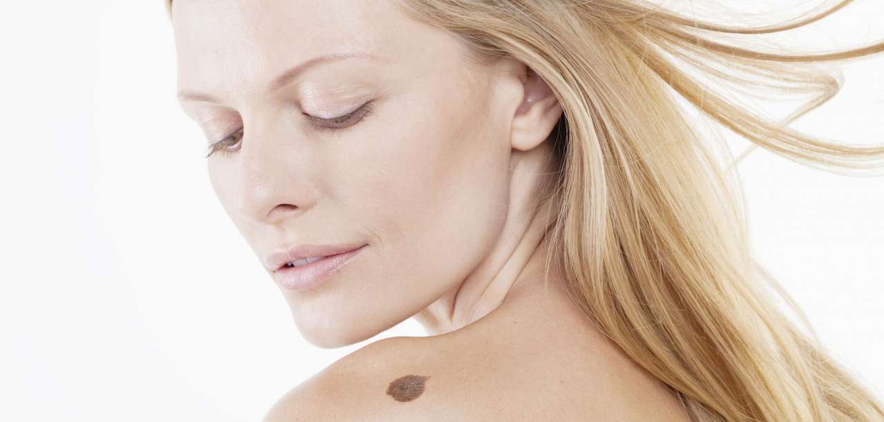 Grain de beauté Clinique Médico Esthétique du VieuxLongueuil