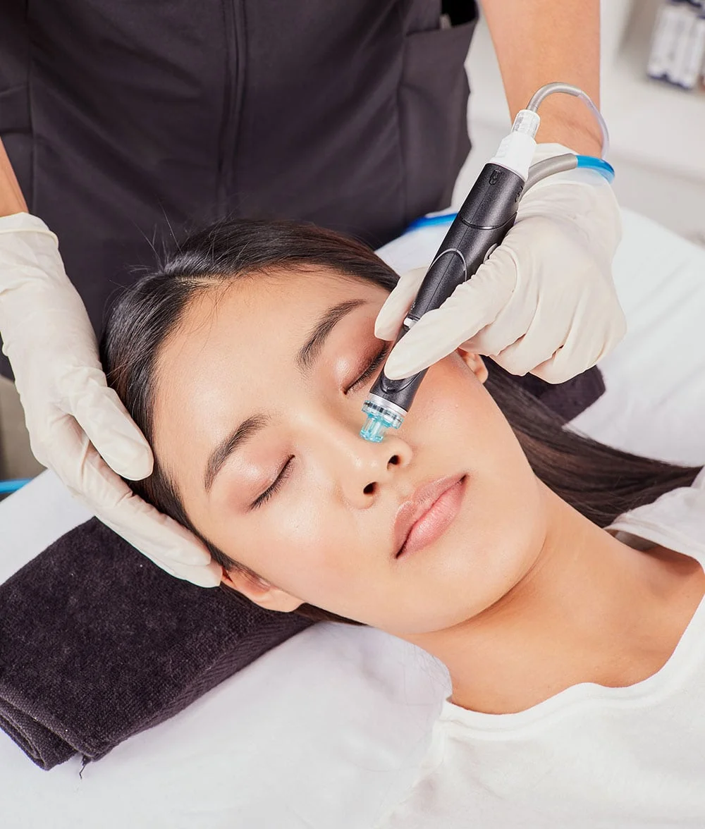 Microdermabrasion Bela MD