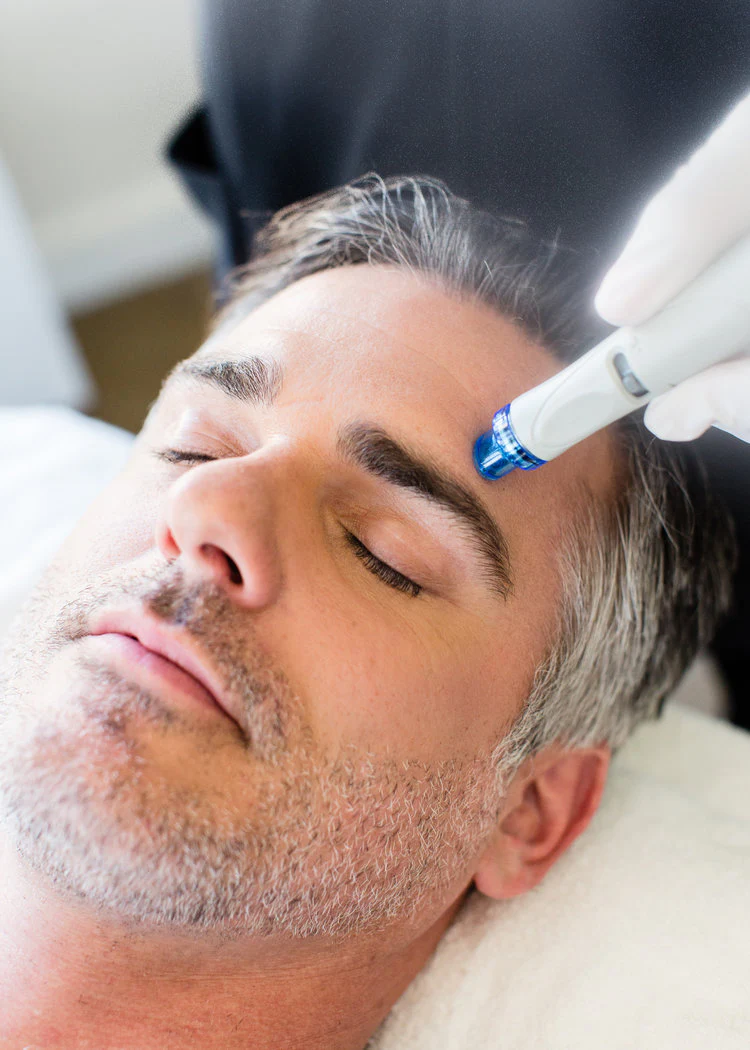 Microdermabrasion Bela MD